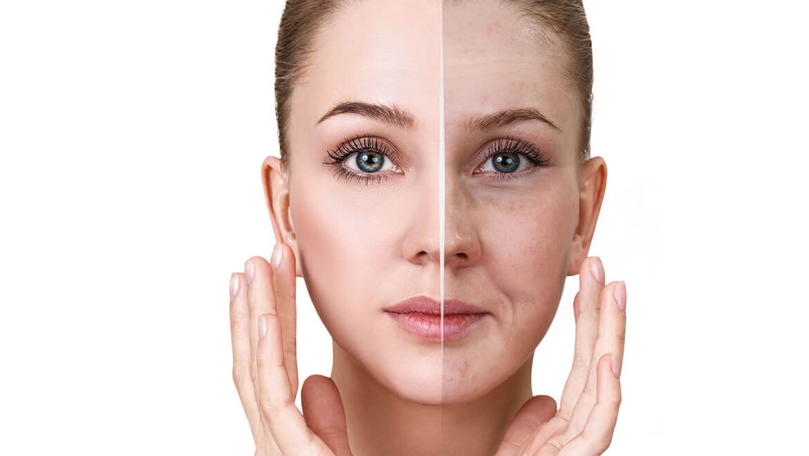 Understanding Sallow Skin: Causes, Symptoms, and Remedies 6 Great ...
